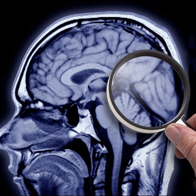 Eine Aufnahme aus einem MRT zeigt die Alzheimer-Region im Gehirn.