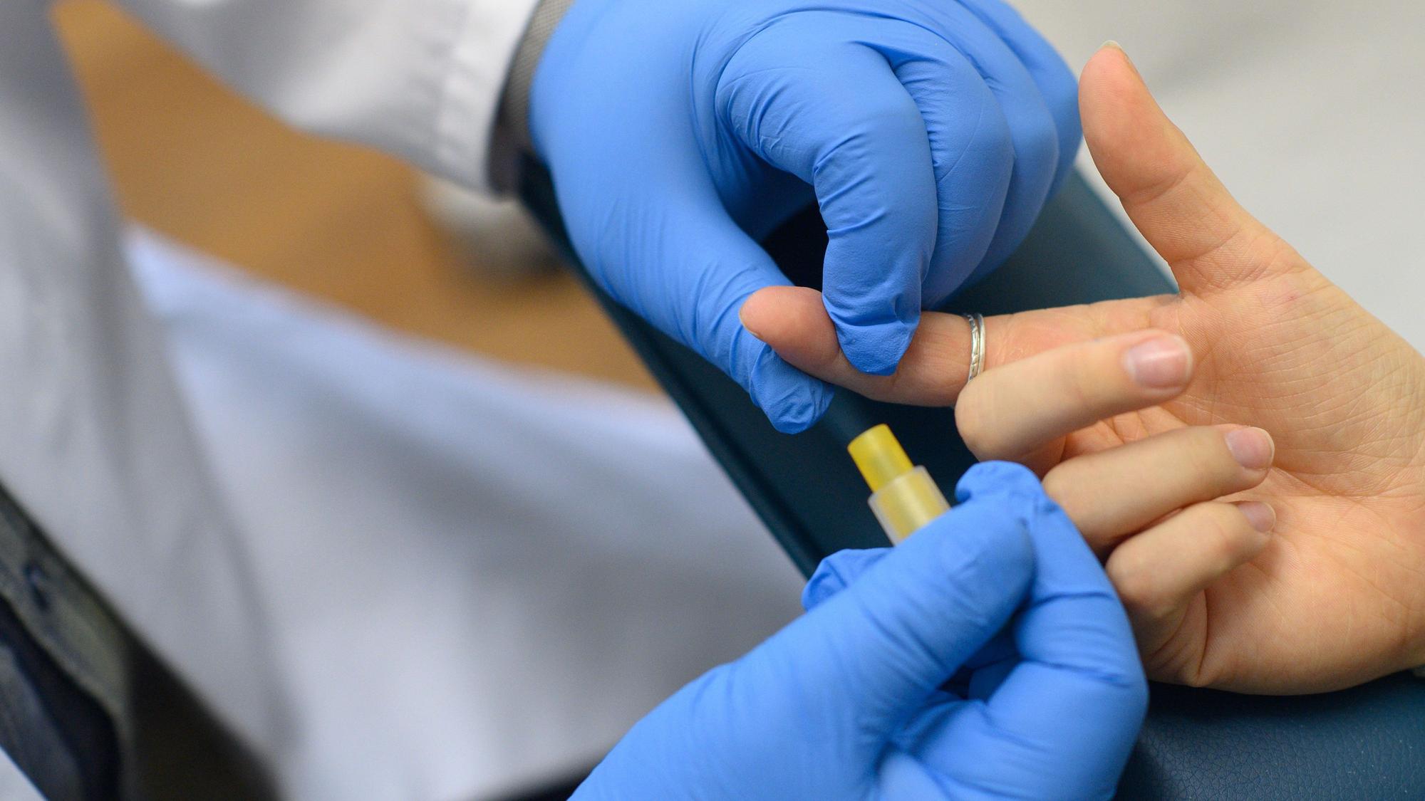 Hände mit Schutzhandschuhen entnehmen Blut an einem Zeigefinger.