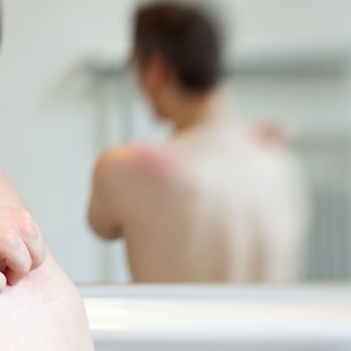 Ein Mann kratzt sich an der Schulter.