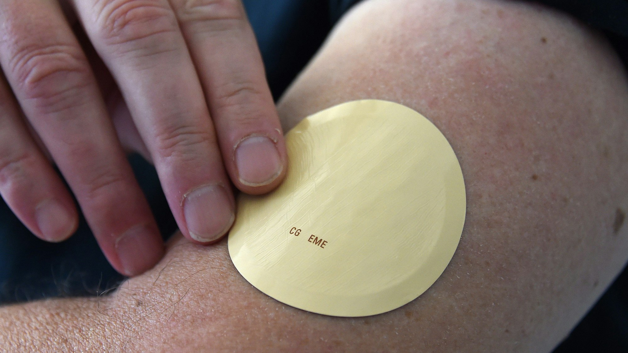 Eine Person klebt sich ein Nikotinpflaster auf den Oberarm.