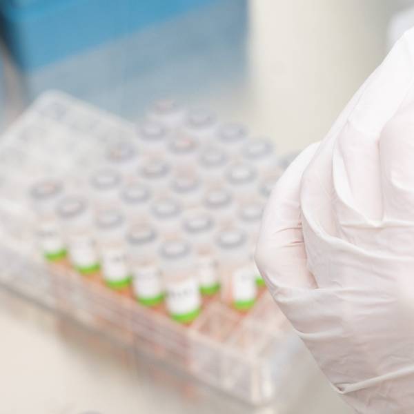 Eine Medizinerin bereitet PCR-Tests gegen das Coronavirus vor. Man sieht nur die Hände und Test-Proben.
