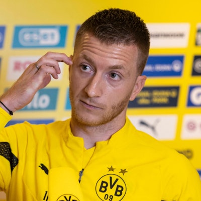 Marco Reus fasst sich bei einer Medienrunde mit Journalisten an die Wange.