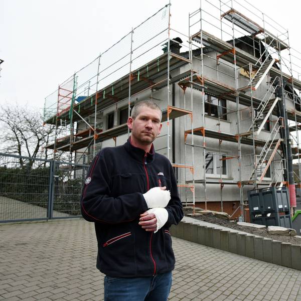 Ein Mann mit verletzten Händen steht vor dem abgebrannten Haus