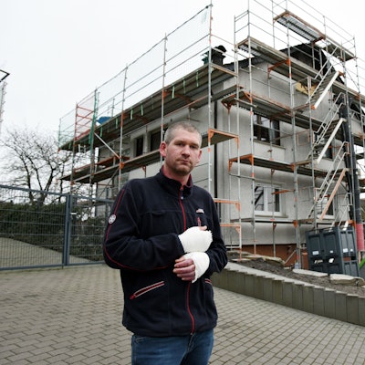 Ein Mann mit verletzten Händen steht vor dem abgebrannten Haus