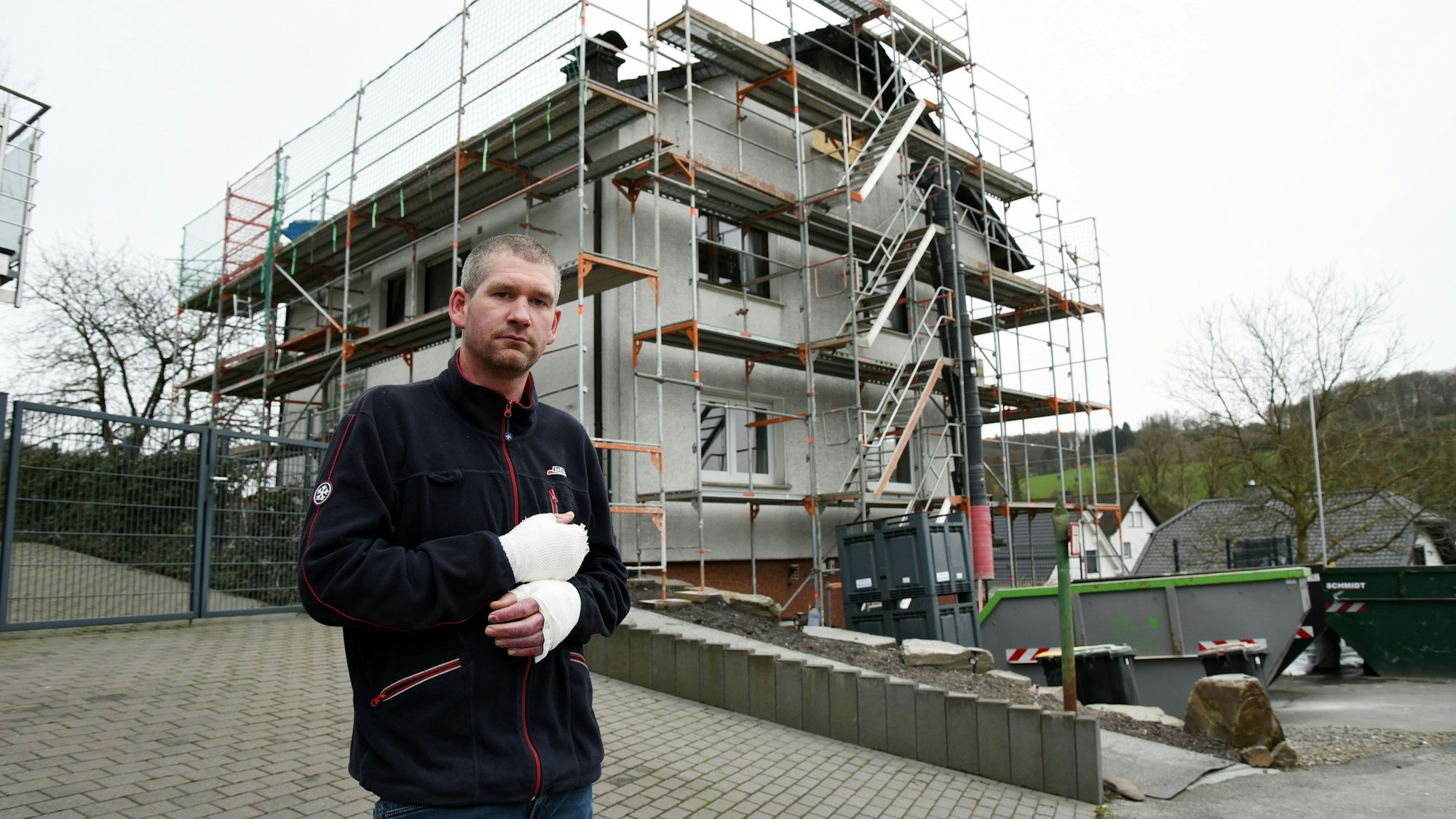 Ein Mann mit verletzten Händen steht vor dem abgebrannten Haus