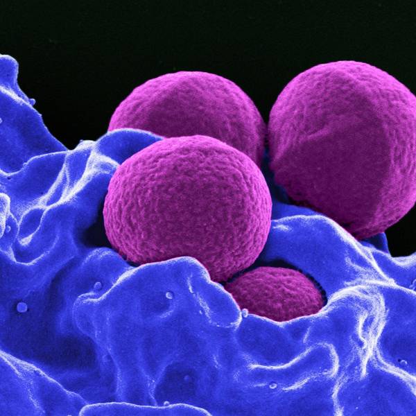 Produziert vom National Institute of Allergy and Infectious Diseases (NIAID), zeigt diese digital gefärbte Rasterelektronenmikroskopie (REM) vier magentafarbene, kugelförmige Methicillin-resistente Staphylococcus aureus (MRSA) Bakterien, die von blau gefärbten weißen Blutkörperchen (WBCs) phagozysiert werden.
