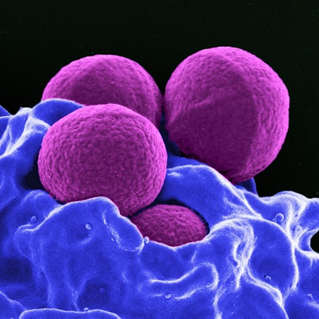Produziert vom National Institute of Allergy and Infectious Diseases (NIAID), zeigt diese digital gefärbte Rasterelektronenmikroskopie (REM) vier magentafarbene, kugelförmige Methicillin-resistente Staphylococcus aureus (MRSA) Bakterien, die von blau gefärbten weißen Blutkörperchen (WBCs) phagozysiert werden.