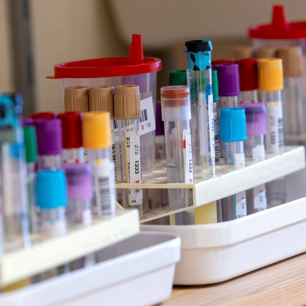 Ein Vogelgrippe-Ausbruch in Europa besorgt Virologen und Experten. Die Übertragung von Säugetier zu Säugetier sei ein Zeichen für Mutationen, die auch für Menschen gefährlich sein könnten. (Symbolbild)