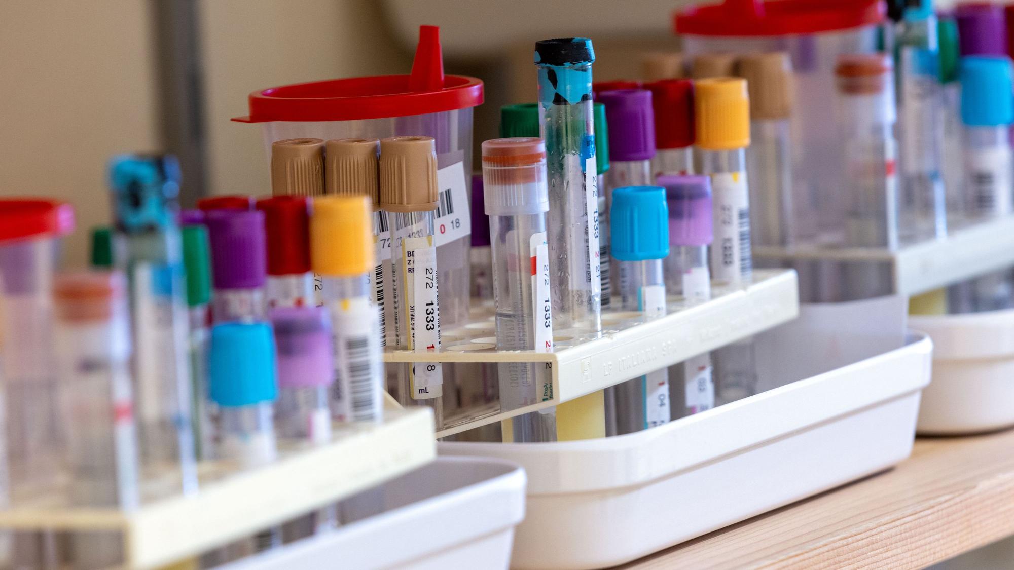 Ein Vogelgrippe-Ausbruch in Europa besorgt Virologen und Experten. Die Übertragung von Säugetier zu Säugetier sei ein Zeichen für Mutationen, die auch für Menschen gefährlich sein könnten. (Symbolbild)