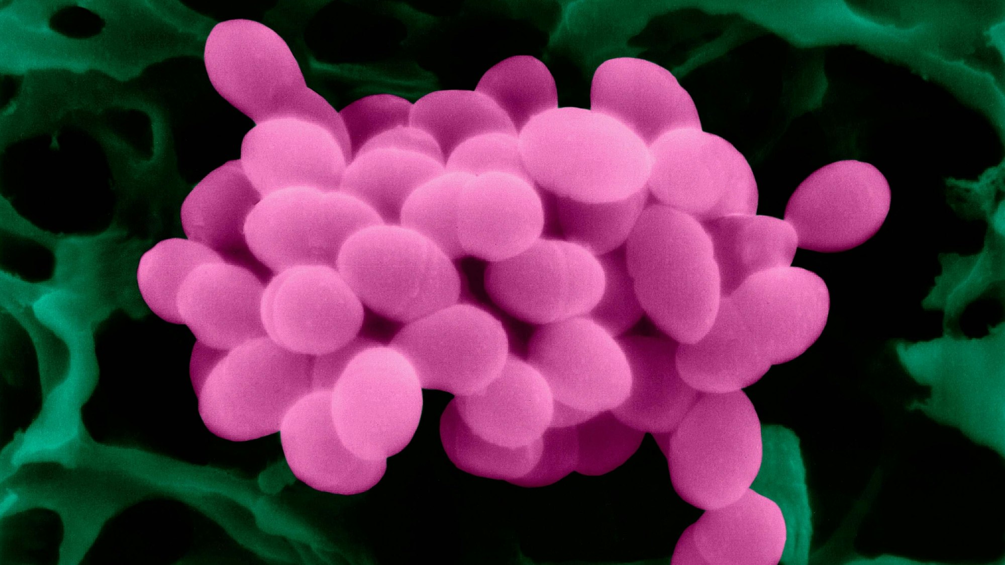 Streptokokken unter dem Elektronenmikroskop