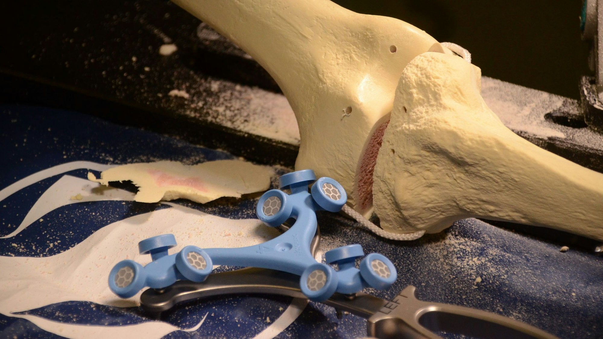 Sensoren eines Roboters liegen neben einem künstlichen Knie.