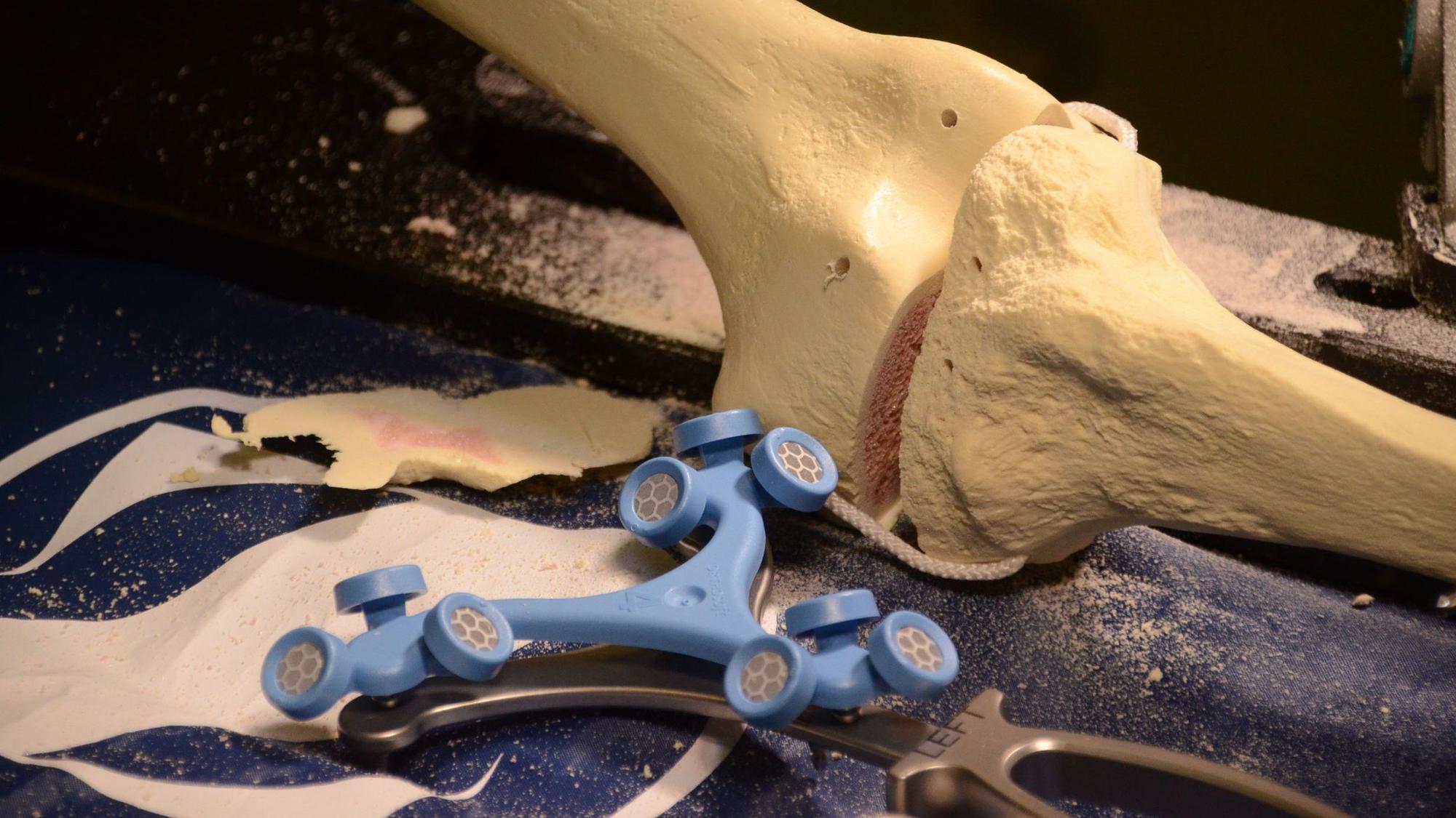 Sensoren eines Roboters liegen neben einem künstlichen Knie.