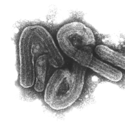 Eine elektronenmikroskopische Aufnahme des Marburg-Virus (undatiertes Handout).