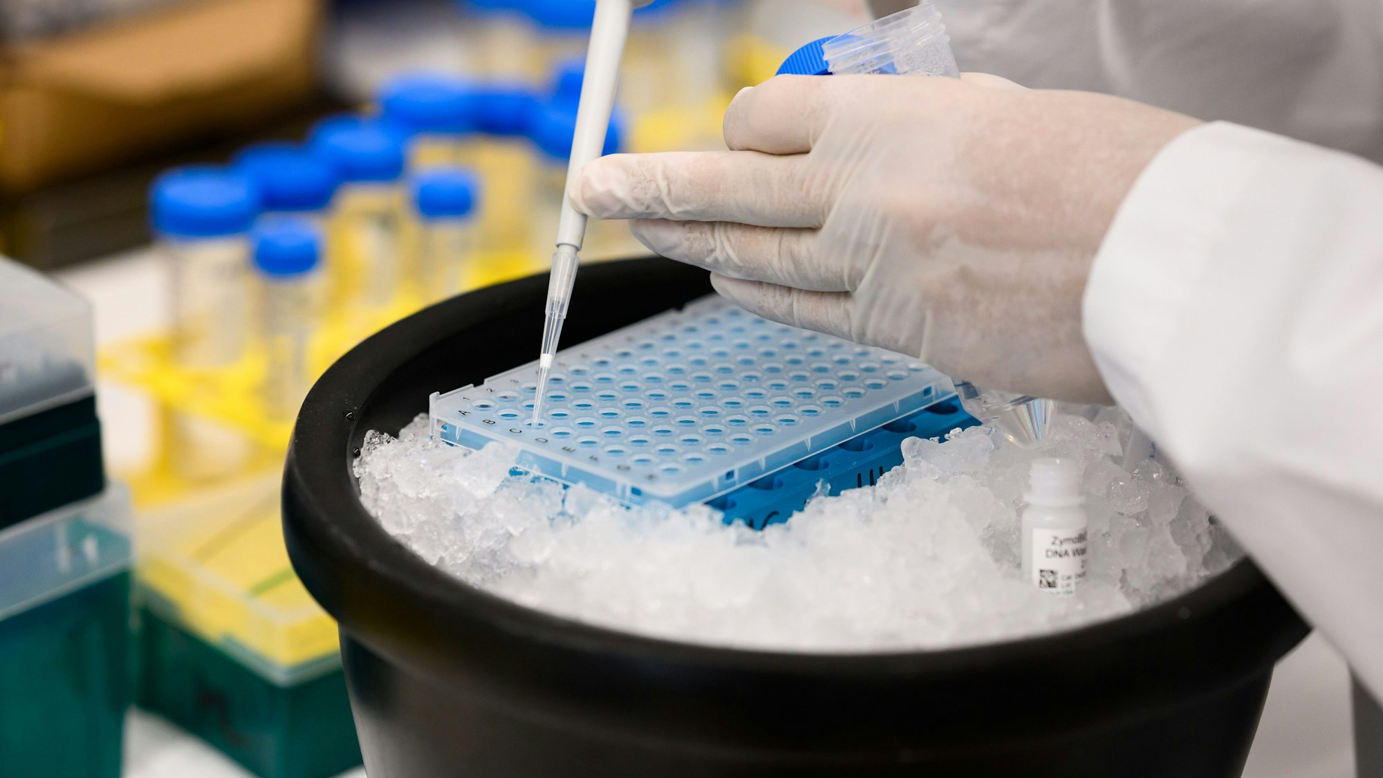 Untersuchung von Abwasserproben auf Krankheitserreger.