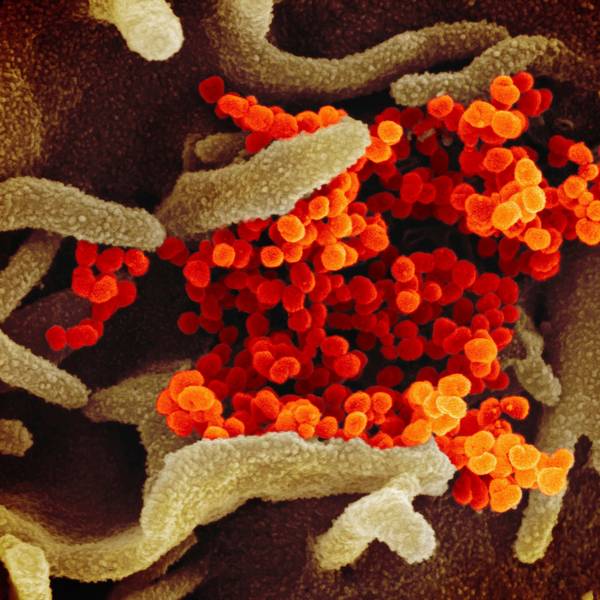 Eine undatierte elektronenmikroskopische Aufnahme des U.S. National Institute of Health zeigt das neuartige Coronavirus (SARS-CoV-2). (Archivbild)