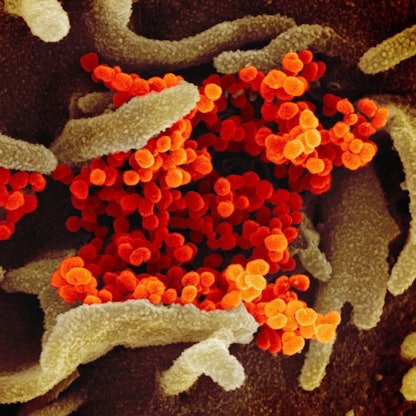 Eine undatierte elektronenmikroskopische Aufnahme des U.S. National Institute of Health zeigt das neuartige Coronavirus (SARS-CoV-2). (Archivbild)