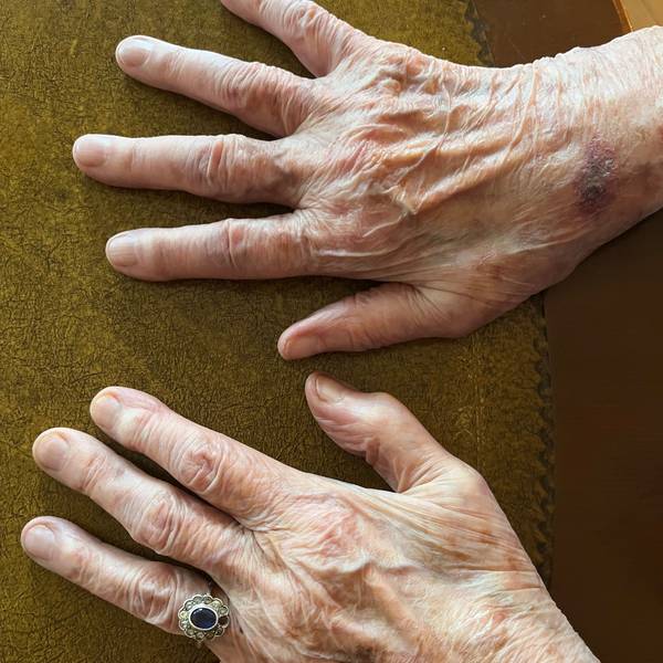 Detailaufnahme der Hand von Anna Nussbächer (97), die den Holocaust überlebt hat. Der Ring stammt von ihrer Mutter.