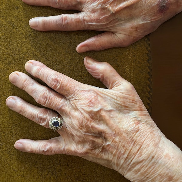 Detailaufnahme der Hand von Anna Nussbächer (97), die den Holocaust überlebt hat. Der Ring stammt von ihrer Mutter.