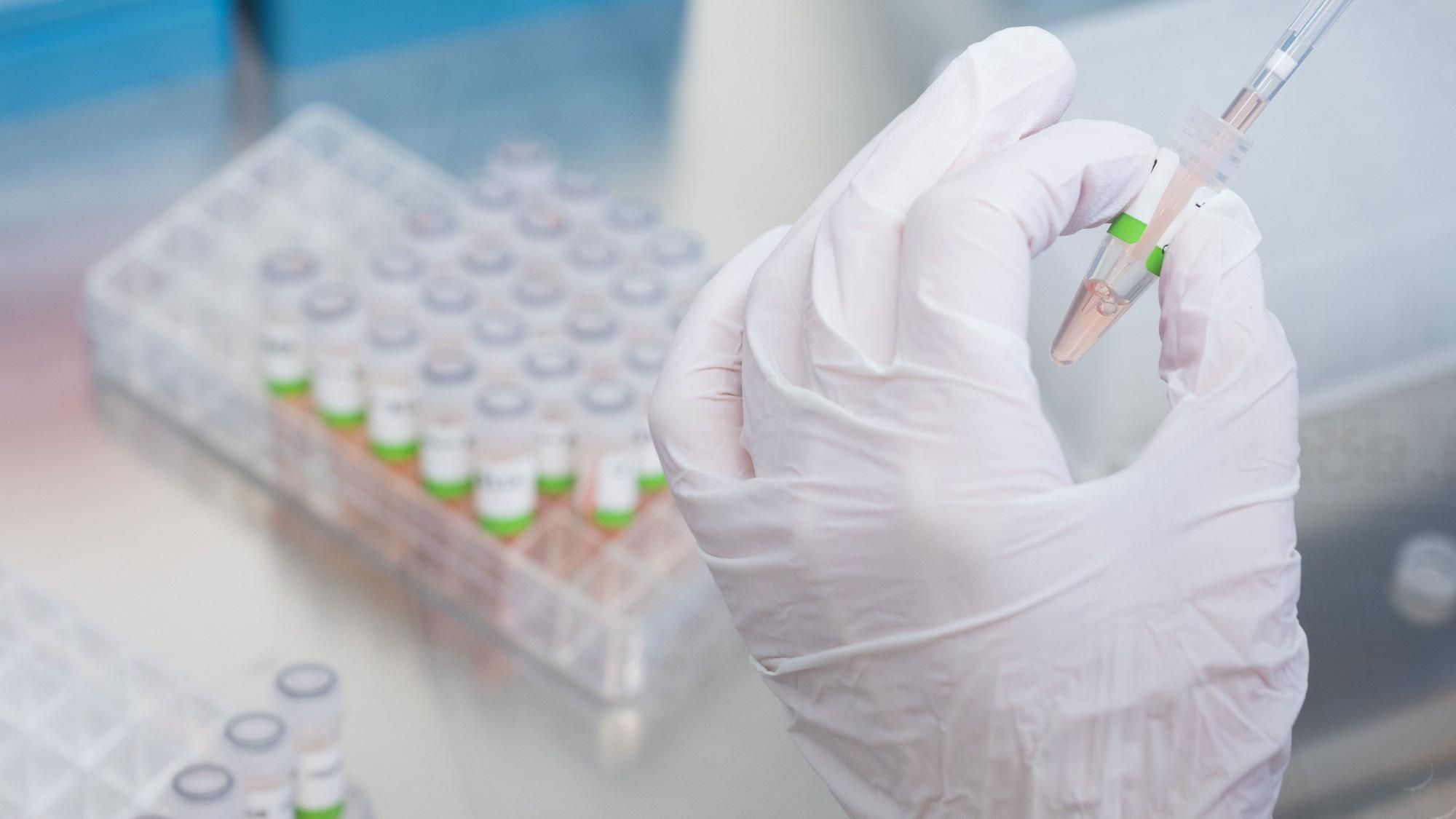 Eine biologisch-technische Assistentin mit Proben von Patienten im Labor. (Symbolbild)
