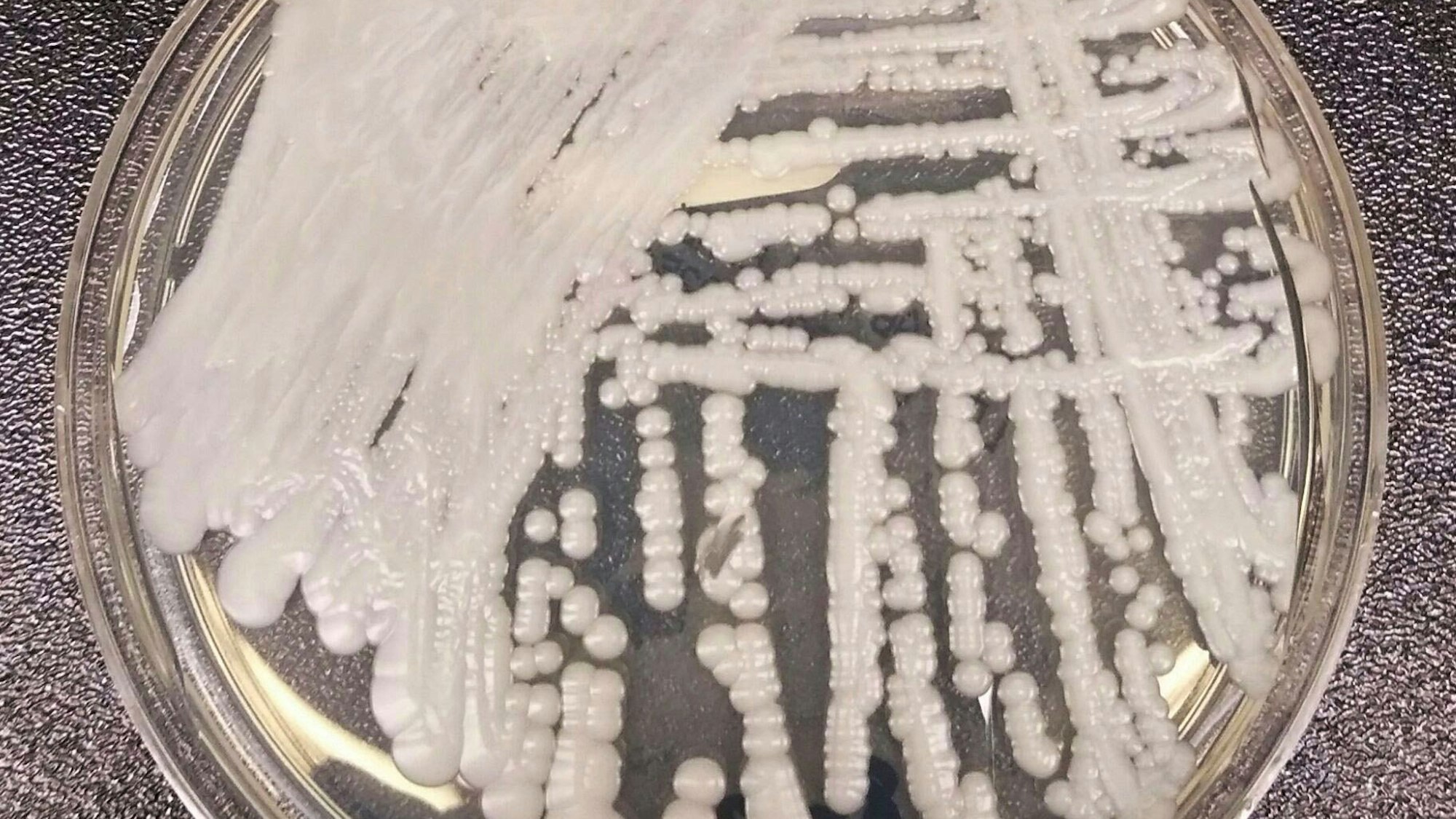 Ein Stamm von Candida auris, kultiviert in einer Petrischale.