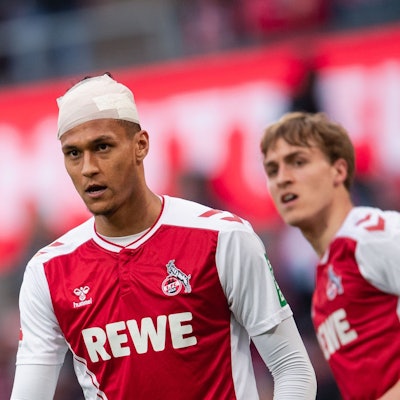 Kölns Stürmer Davie Selke spielte nach seiner Kopfverletzung mit einem Turban weiter.