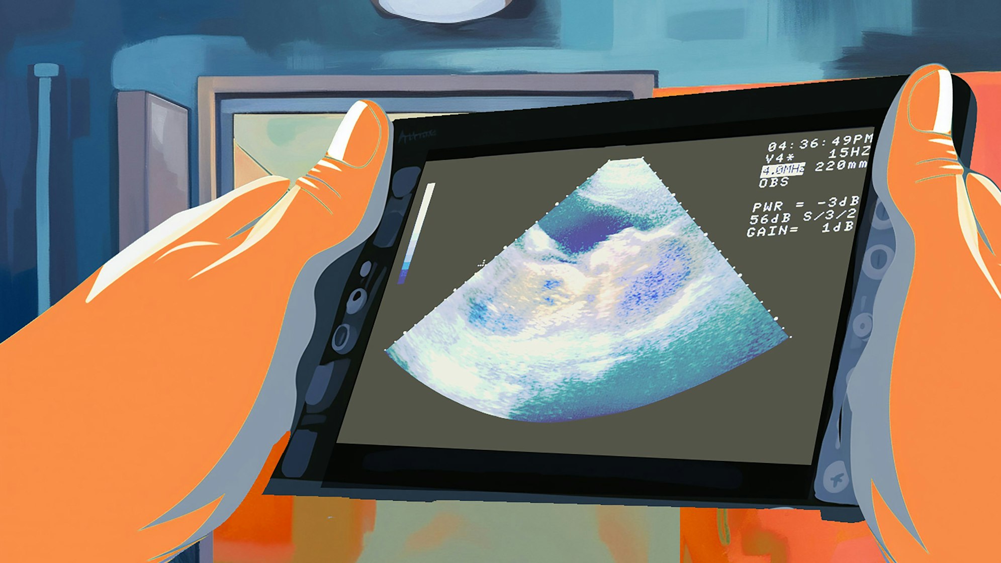 Garfik von zwei Hände, die einen Bildschirm mit Utltraschallaufnahme eines Embryos halten.