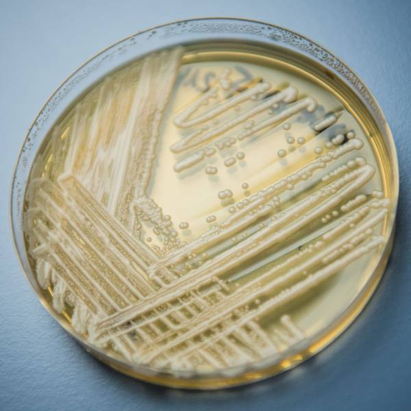 Der Hefepilz Candida auris in einer Petrischale, aufgenommen in einem Labor.
