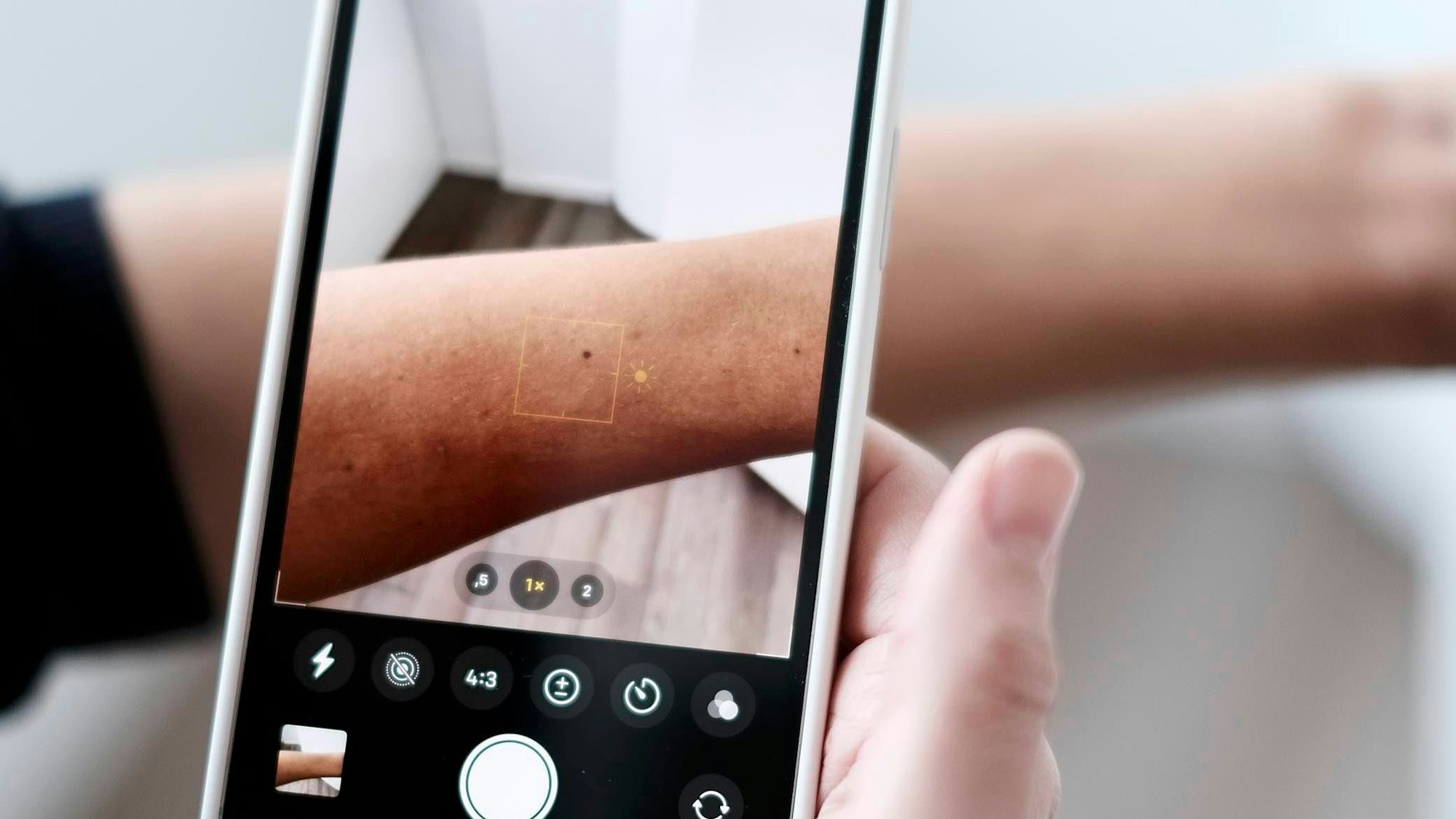 KI in der Dermatologie: Eine Frau fotografiert mit einem Handy die Haut auf ihrem Arm ab.