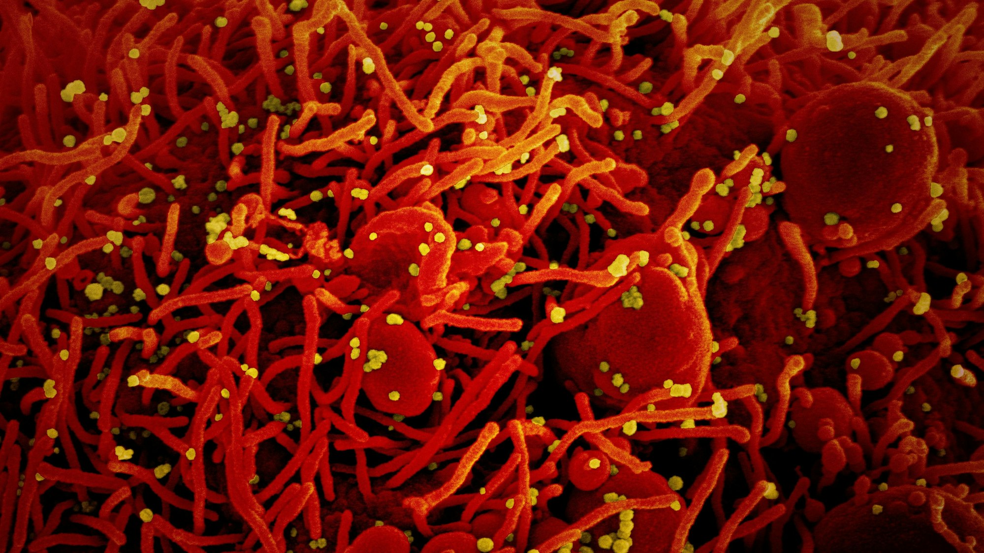 Eine Aufnahme des Coronavirus unter einem Mikroskop, bereitgestellt vom US-Forschungszentrum „National Institute of Allergy and Infectious Diseases“ (NIAID).