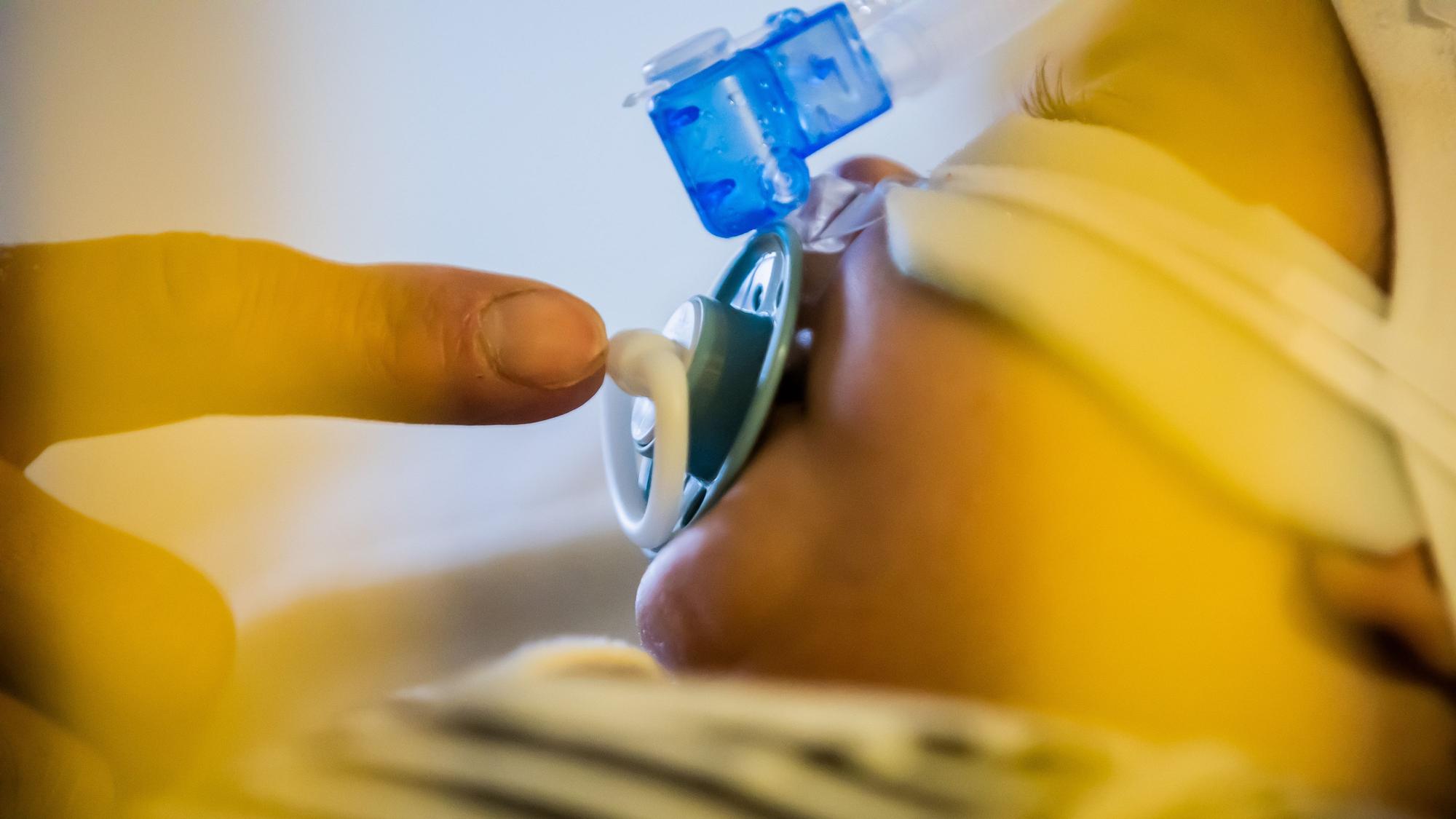 Ein Vater betreut seinen achteinhalb Monate alten Sohn, der mit einem Atemwegsinfekt auf der Intensivstation einer Kinderklinik liegt und non-invasiv beatmet wird (CPAP-Beatmung).