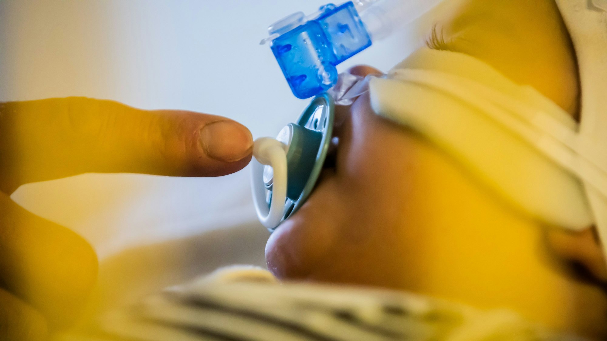 Ein Vater betreut seinen achteinhalb Monate alten Sohn, der mit einem Atemwegsinfekt auf der Intensivstation einer Kinderklinik liegt und non-invasiv beatmet wird (CPAP-Beatmung).