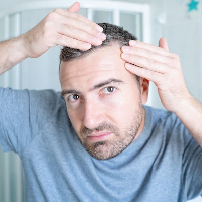 Mann ist besorgt über seine Geheimratsecken