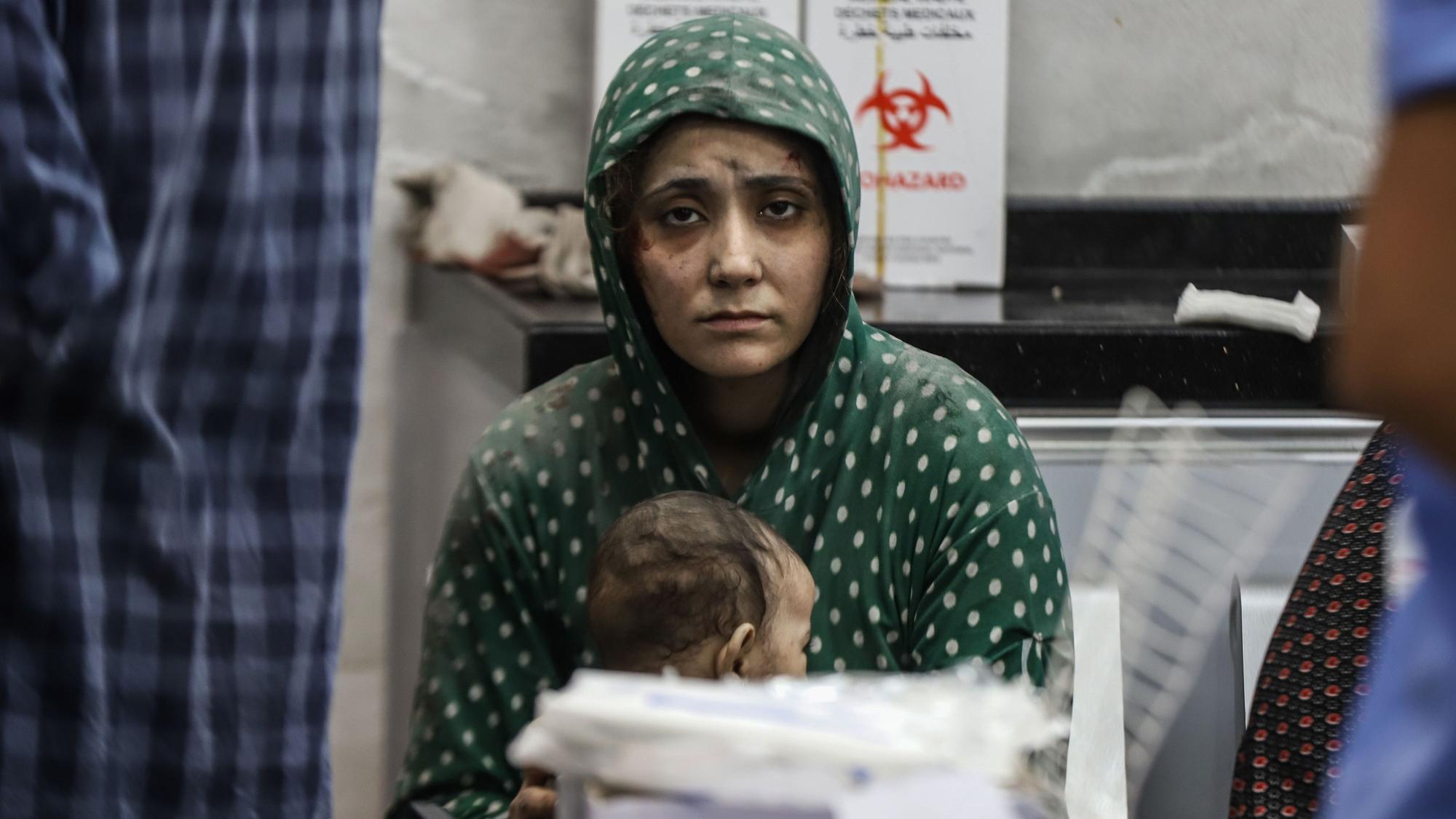Eine bei israelischen Angriffen verletzte Palästinenserin wartet im Schifa-Krankenhaus in Gaza auf ihre Behandlung.