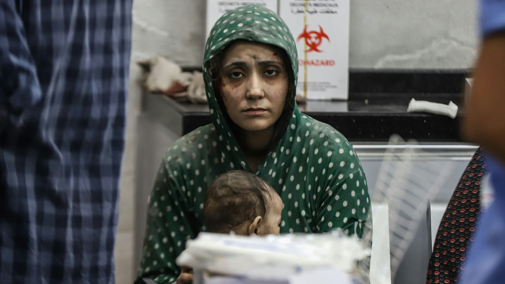 Eine bei israelischen Angriffen verletzte Palästinenserin wartet im Schifa-Krankenhaus in Gaza auf ihre Behandlung.