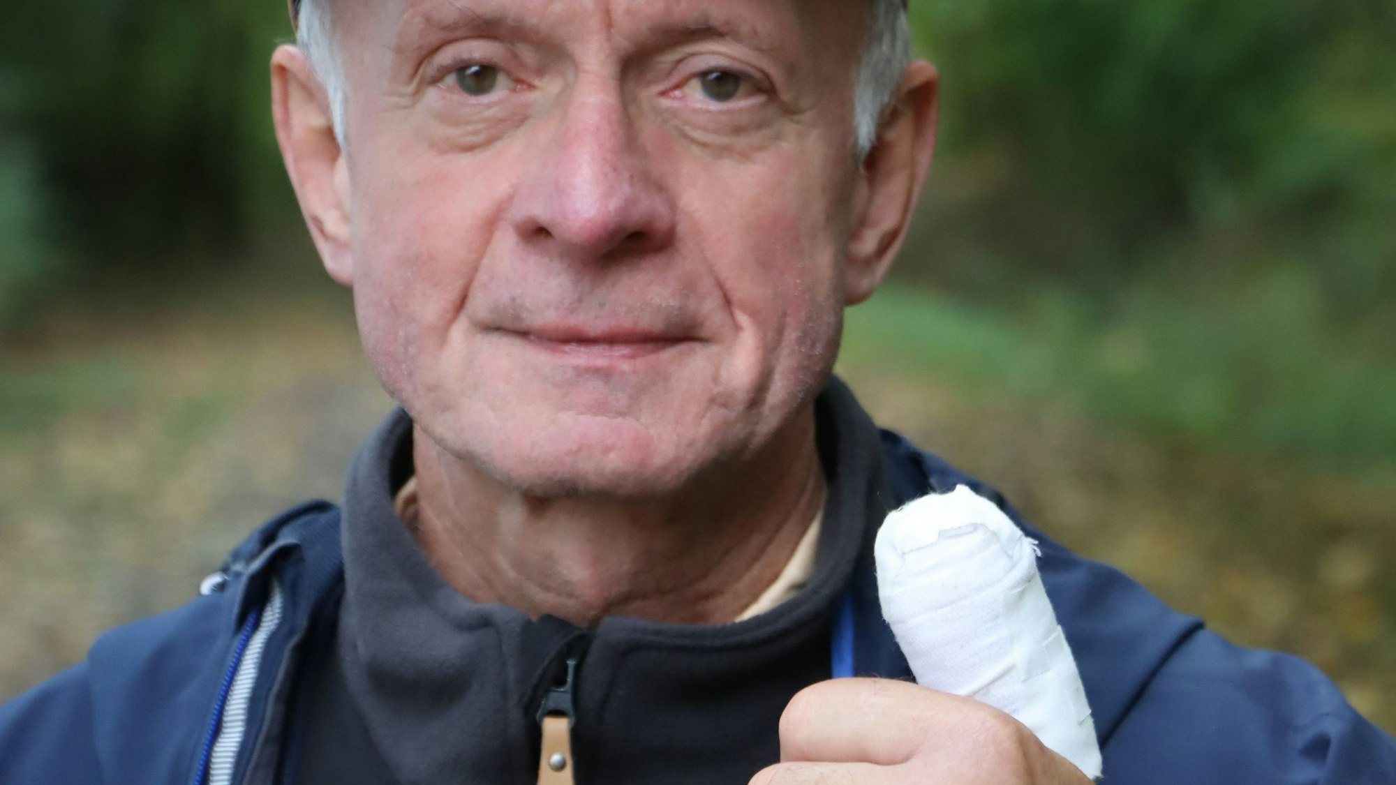 Ein Mann zeigt den bandagierten Daumen seiner linken Hand.