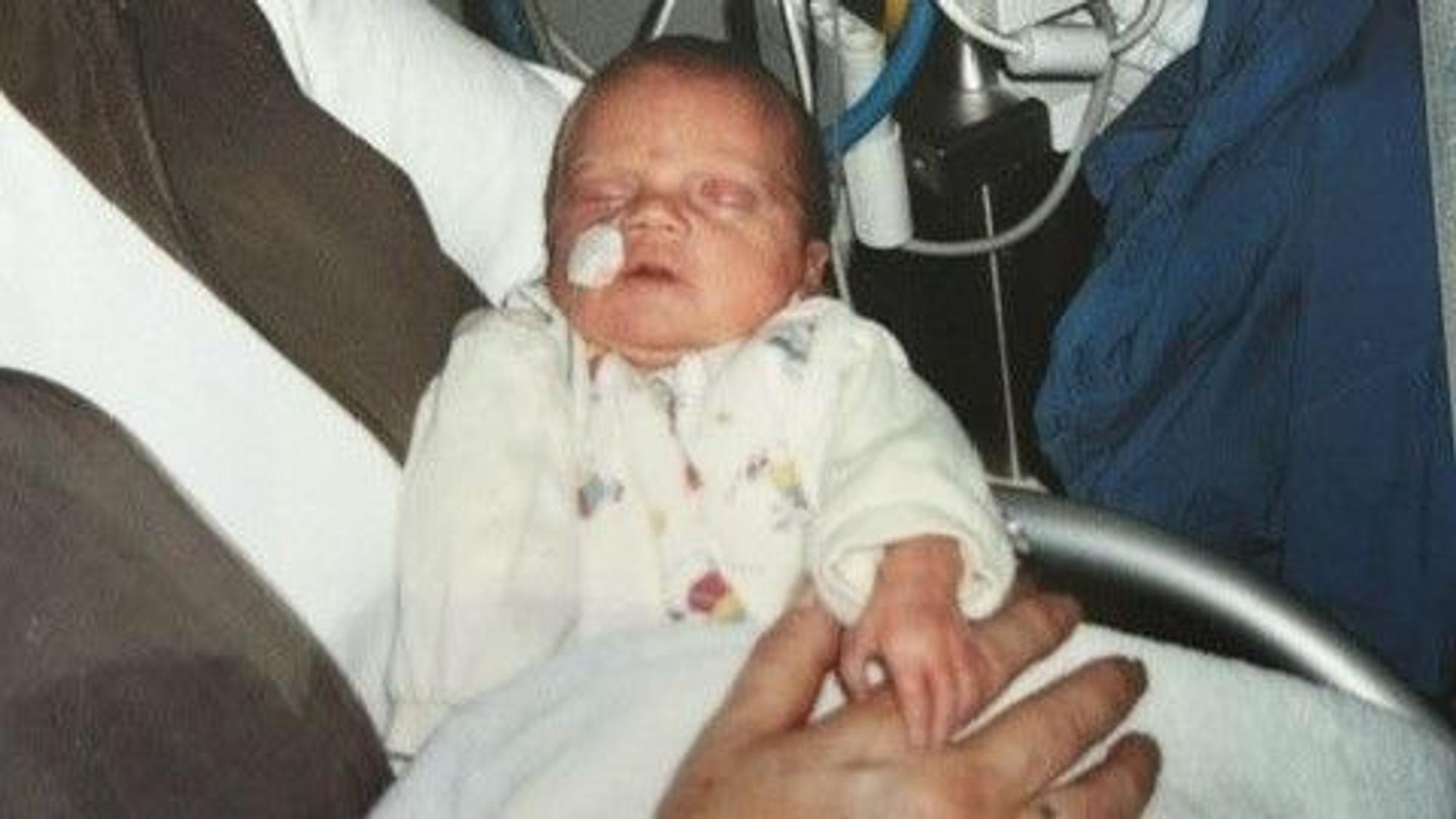 Auf dem Bild ist ein Baby zu sehen, das als Frühchen auf die Welt kam