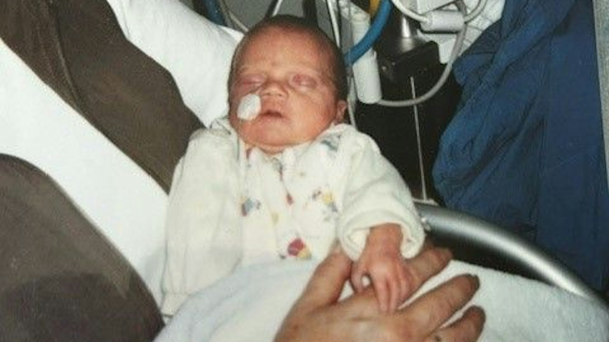 Auf dem Bild ist ein Baby zu sehen, das als Frühchen auf die Welt kam