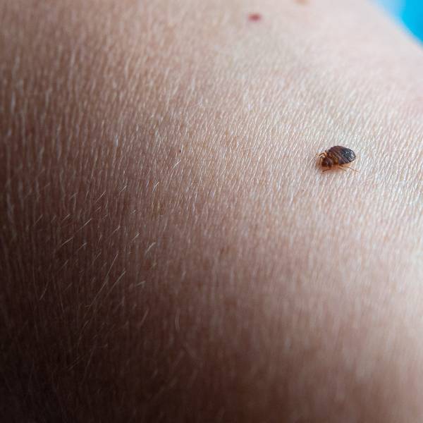Eine Bettwanze beißt in einen Arm (Symbolbild). In Frankreich gibt es Aufregung um die Verbreitung von Bettwanzen. Vor Olympia rüsten einige Hotels nun auf.