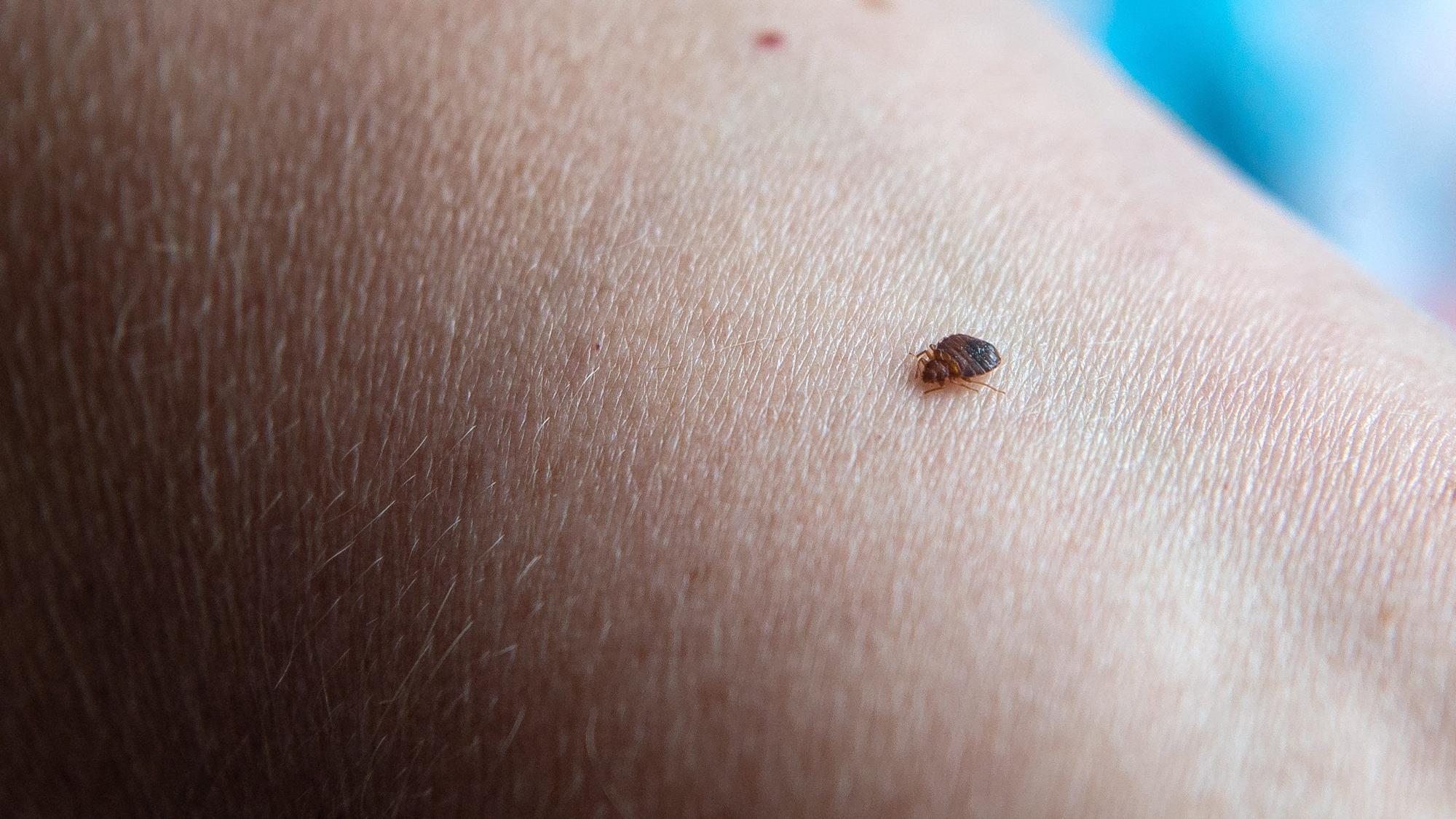 Eine Bettwanze beißt in einen Arm (Symbolbild). In Frankreich gibt es Aufregung um die Verbreitung von Bettwanzen. Vor Olympia rüsten einige Hotels nun auf.