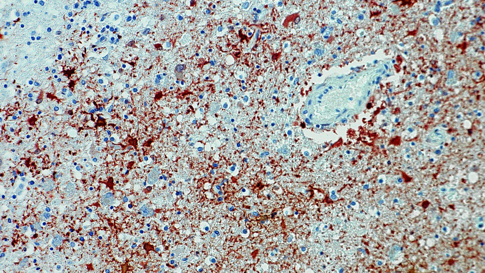 Eine Aufnahme eines Mikroskops zeigt das Borna-Virus mit Antikörpern, die sich in kurzer Zeit gebildet haben.