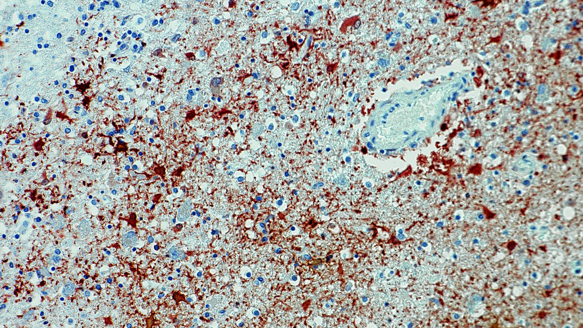 Eine Aufnahme eines Mikroskops zeigt das Borna-Virus mit Antikörpern, die sich in kurzer Zeit gebildet haben.