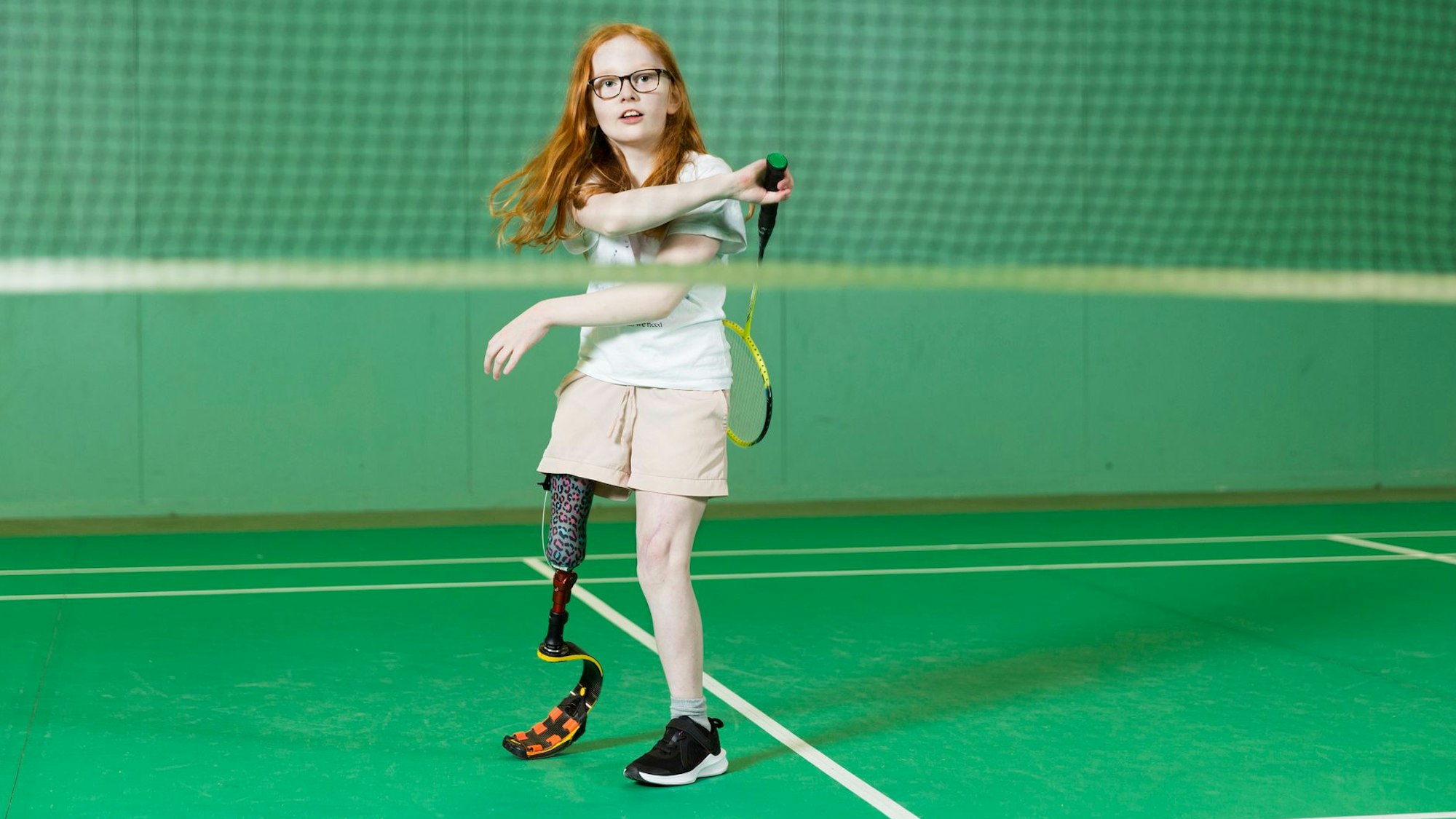 Ein Mädchen mit langen roten Haaren steht auf dem Tennisplatz. Es hat eine Beinprothese.