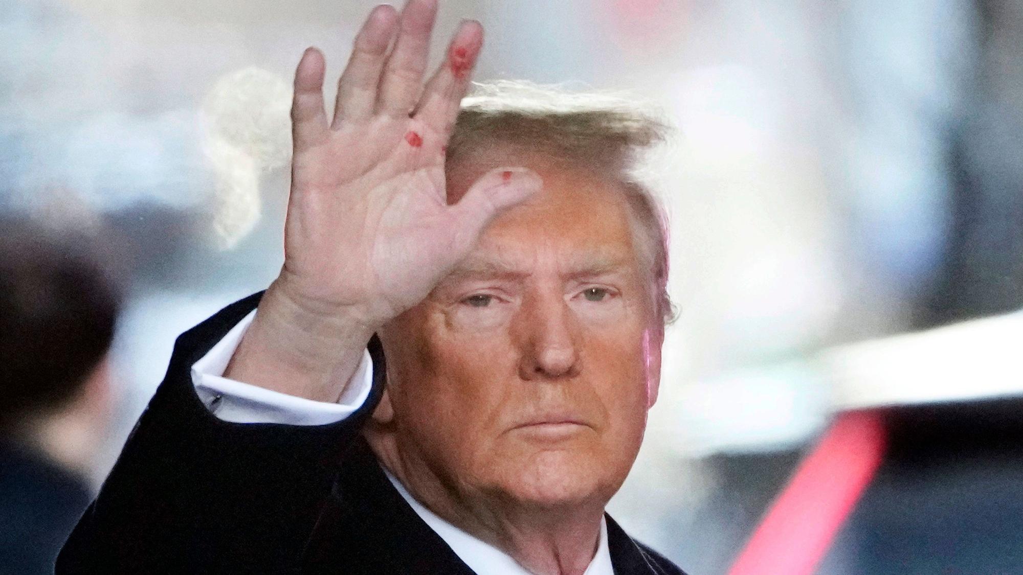 Donald Trump, Präsidentschaftskandidat der Republikaner und ehemaliger Präsident der USA, grüßt Beobachter als er sein Wohnhaus verlässt. Die roten Flecken auf seiner Hand sorgen in den USA für wilde Spekulationen. (Archivbild)
