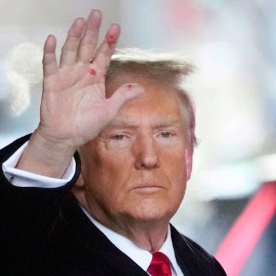 Donald Trump, Präsidentschaftskandidat der Republikaner, hat sichtbar rote Flecken an der Hand. Woher diese stammten, verrieten nun Vertraute des ehemaligen US-Präsidenten.