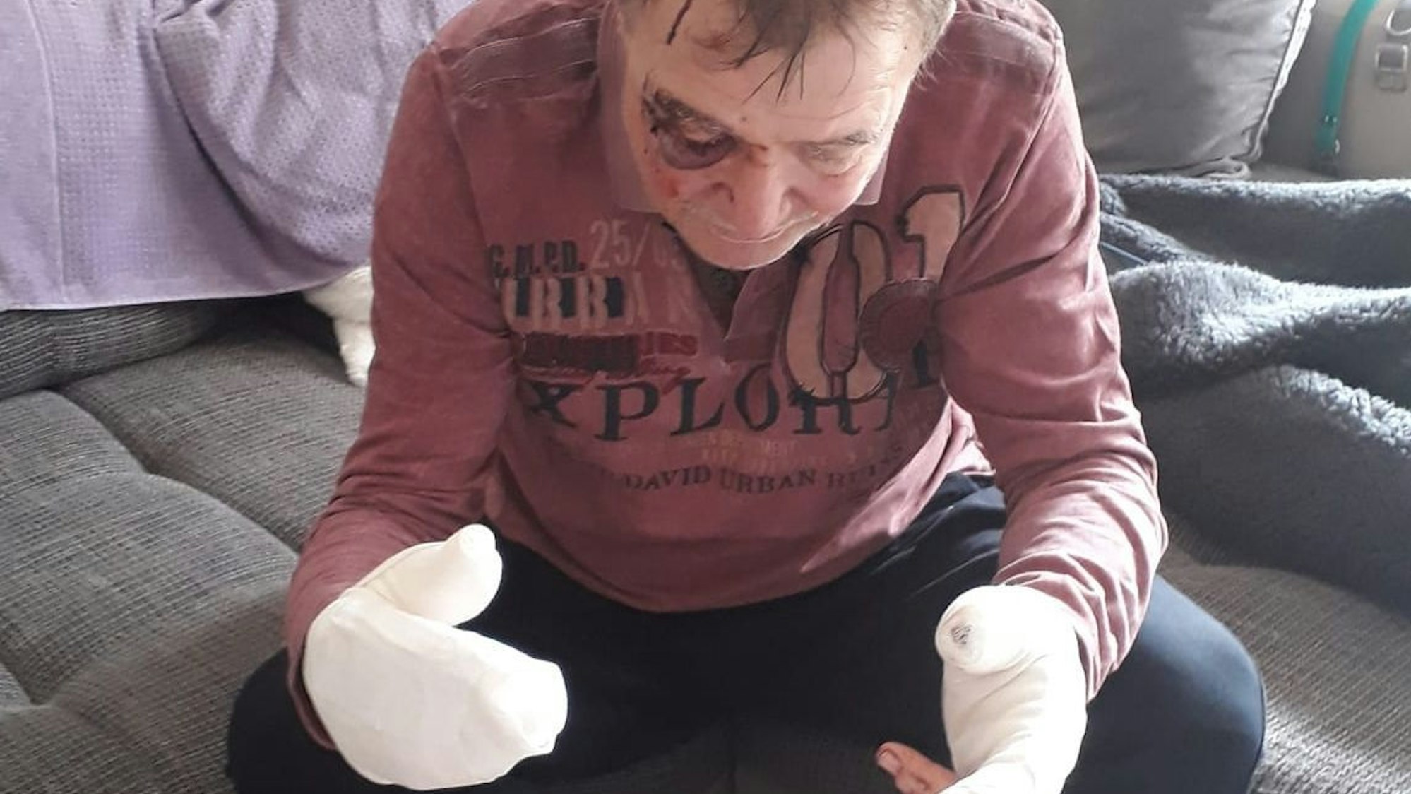 Der Spaziergänger erlitt schwere Verletzungen am Kopf und an den Händen.