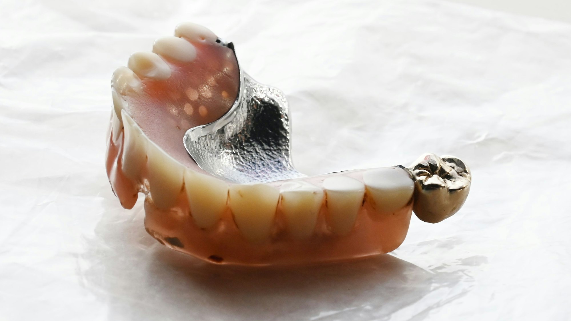 Nahaufnahme einer Zahnprothese mit Zahngold