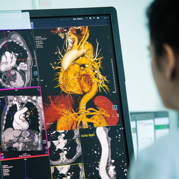 Ein Mitarbeiter sitzt vor einem Monitor, der eine Darstellung der Aorta aus dem Computertomographen (CT) zeigt.