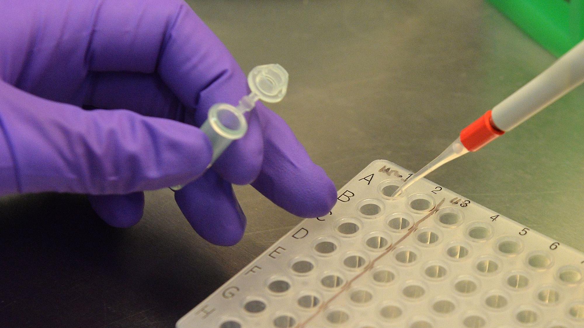 In einem Labor werden Blutproben auf das Virus H5N1, auch bekannt als Vogelgrippe, getestet. Im US-Bundestaat Texas hat sich ein Mann mit der Krankheit infiziert.