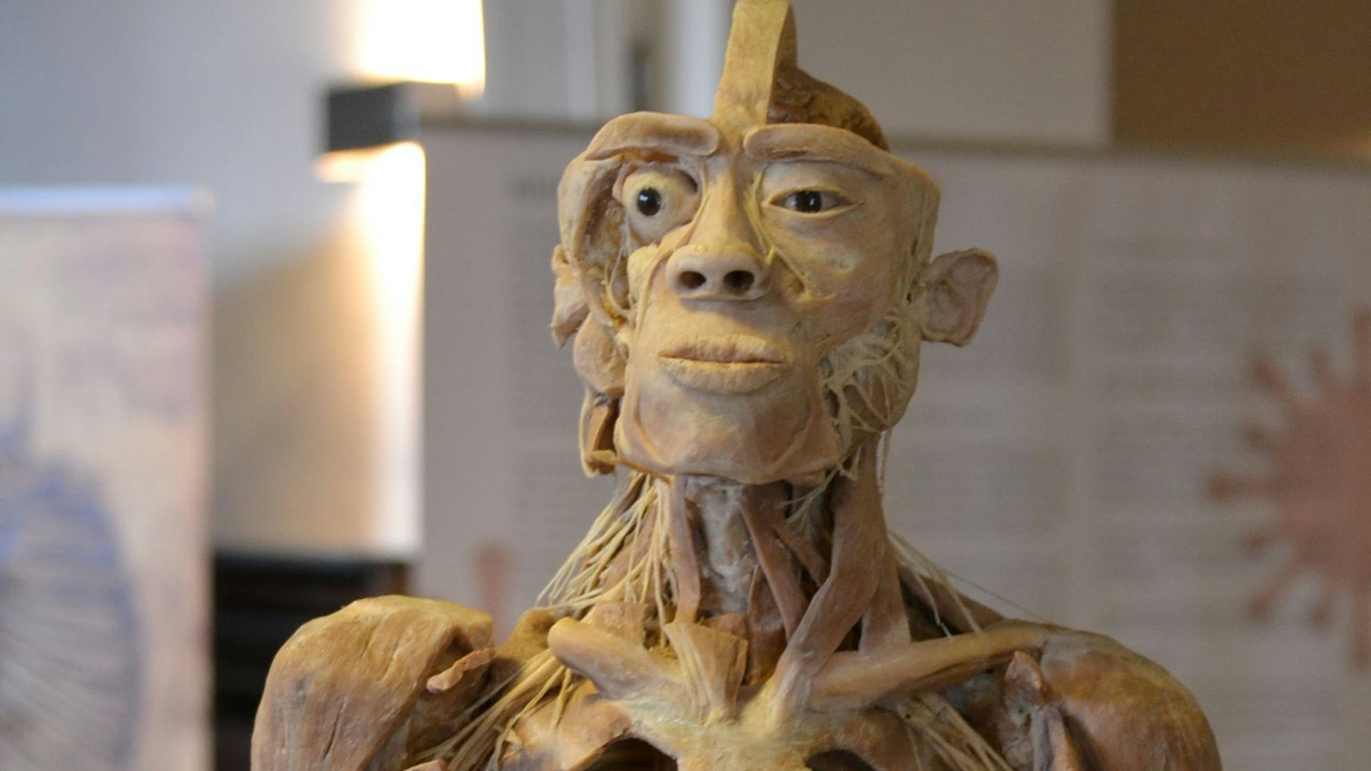 Das Bild zeigt einen präparierten menschlichen Körper.