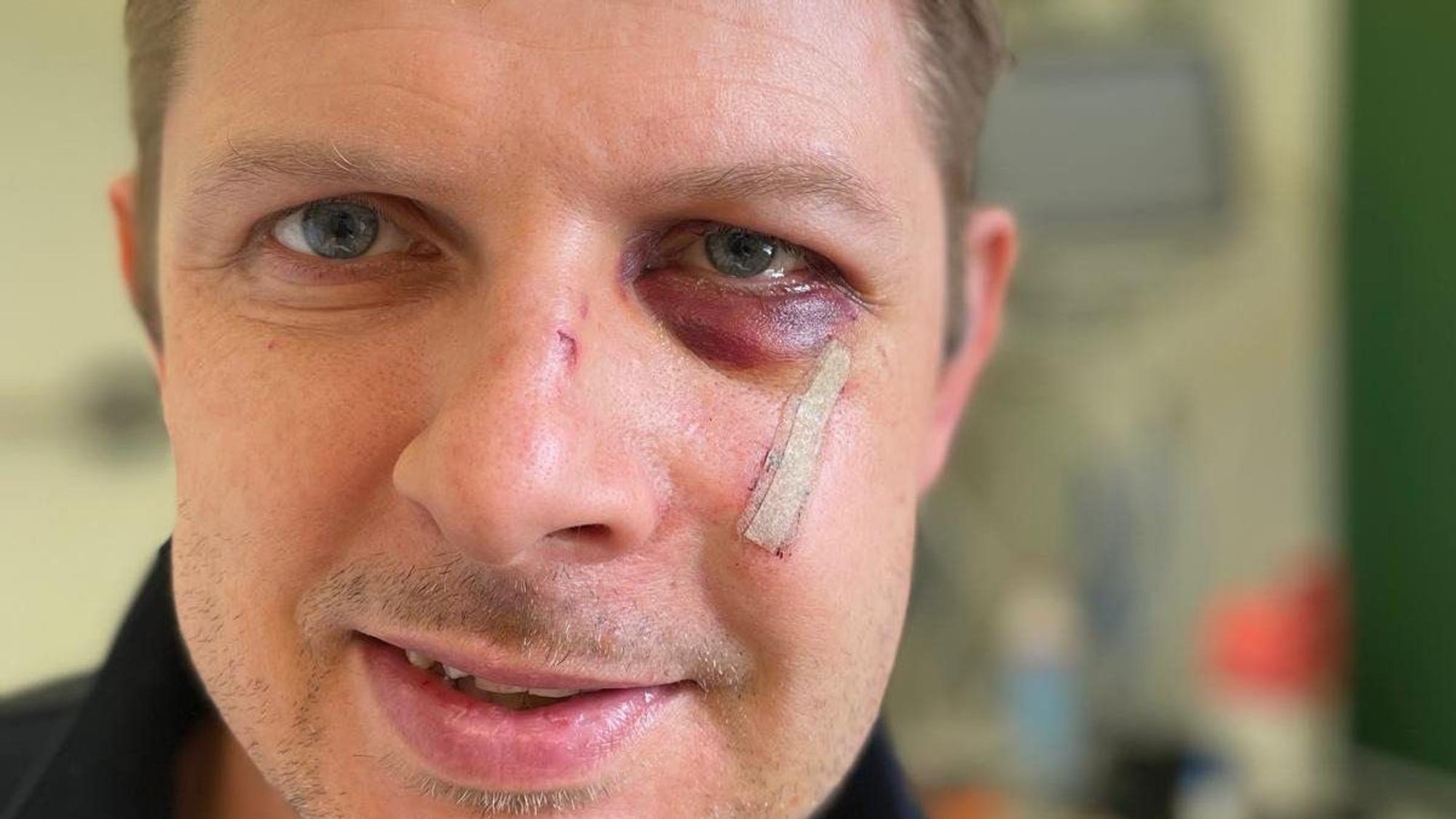 Der SPD-Europaabgeordnete Matthias Ecke hat sich mit einem Dank aus dem Krankenhaus gemeldet.